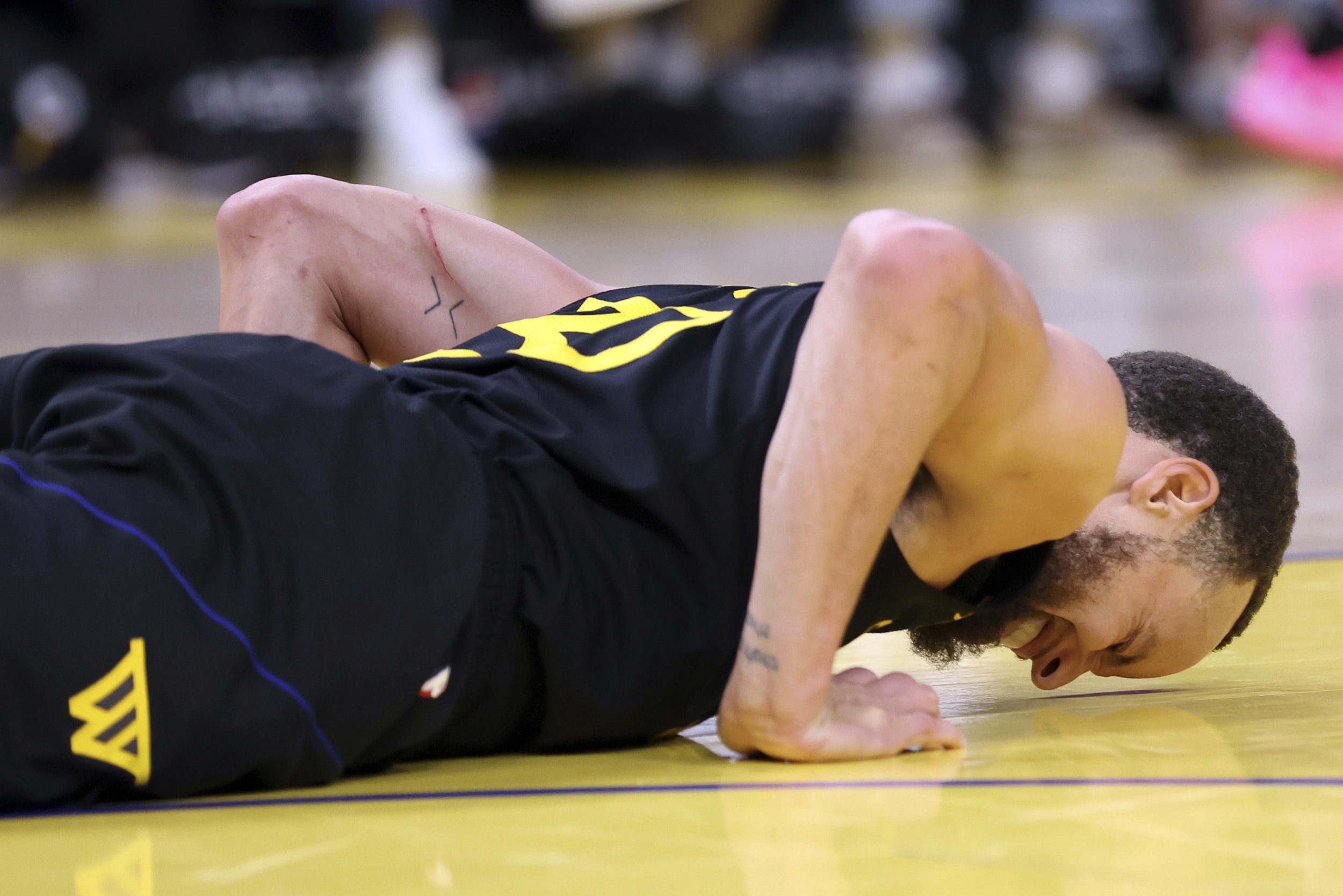 NBA: Warriors’ Steph Curry has contusion, no structural damage